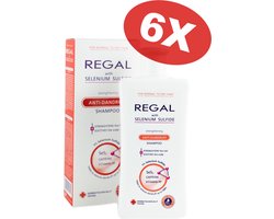 Regal Anti Roos Shampoo – 6 Stuks – Selenium Shampoo met Cafeïne en Niacinamide – Tegen Roos, Jeuk en Schilfering – Normaal tot Droog Haar – 6 x 200 ml