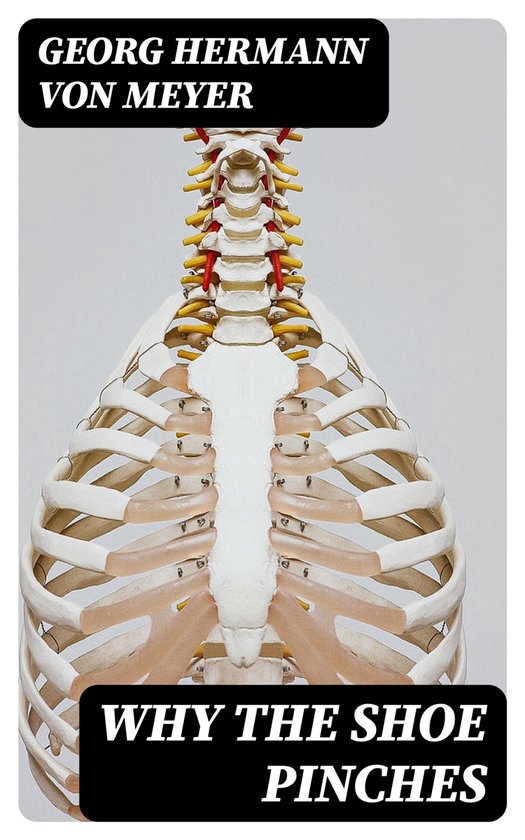 Why the Shoe Pinches (ebook), Hermann Von Meyer 8596547318439