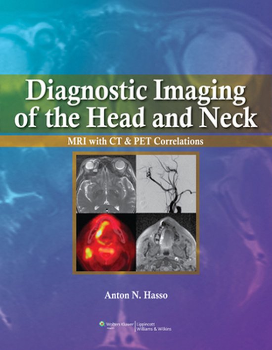 Diagnostic Imaging of the Head and Neck 9780397515370 Anton N