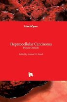 Hepatocellular Carcinoma