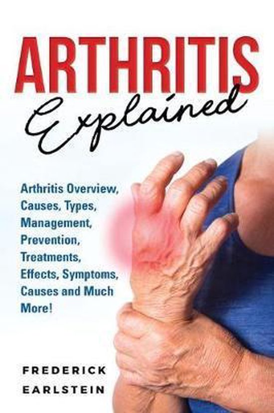 Arthritis Explained, Frederick Earlstein 9781946286871 Boeken