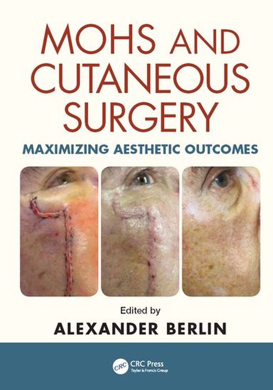 Mohs and Cutaneous Surgery - cover