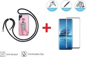 2-In-1 Shockproof Hoesje Met Koord & Screen Protector Set Geschikt Voor Samsung Galaxy S20/S20 5G - Full Cover 3D Edge Tempered Glass Beschermglas Met Siliconen Telefoonkoord Back