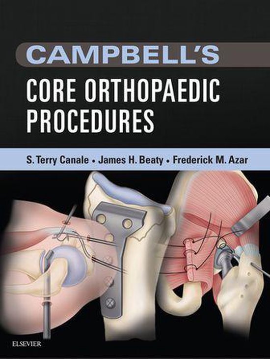 Campbell's Core Orthopaedic Procedures E-Book - cover