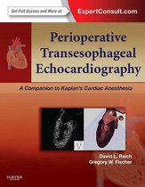 Perioperative Transesophageal Echocardiography E-Book