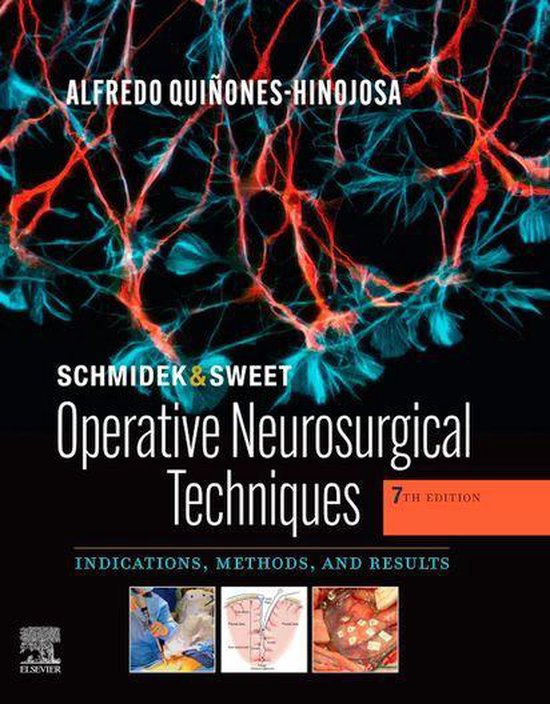 Schmidek and Sweet: Operative Neurosurgical Techniques E-Boo ... - cover