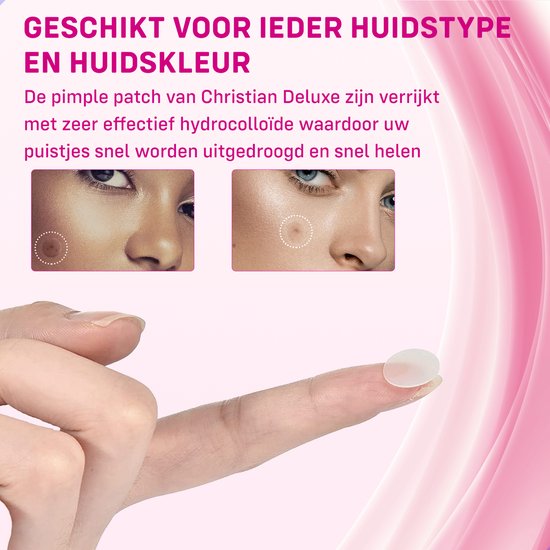 Christian Deluxe® - Pimple patch 180 stuks - Acne patch - Acne - Acne pleister - Pimple patches - Puisten verwijderaar