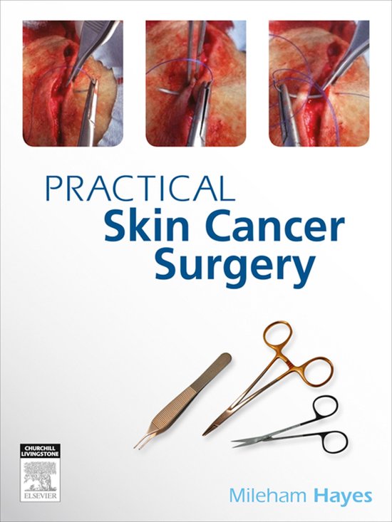 Practical Skin Cancer Surgery - cover
