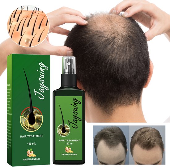 Jaysuing Haarvariant – Haarwortel Serum – Terragon + Gember – Stimuleert Haargroei, Voedt de Huid, Vermindert Haaruitval
