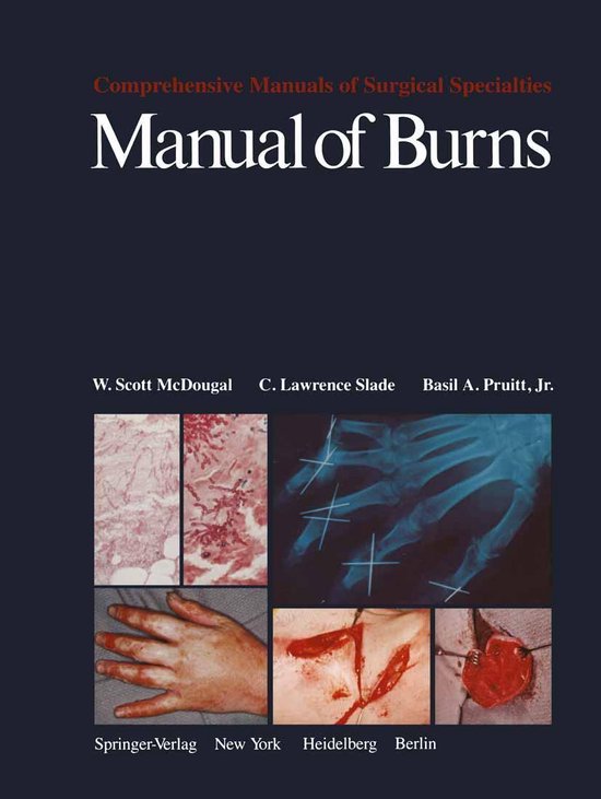 Medicine (R0) - Manual of Burns - cover