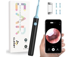 Oorsmeer Verwijderaar met Camera - Oorreiniger met App - Ear Cleaner - Oorlepel - Earscratcher voor Oor Schoonmaken - Wifi - Zwart