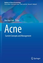 Updates in Clinical Dermatology - Acne