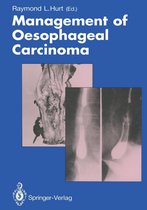 Management of Oesophageal Carcinoma