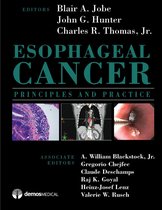 ISBN Esophageal Cancer: Principles and Practice, Anglais, Couverture rigide, 1050 pages