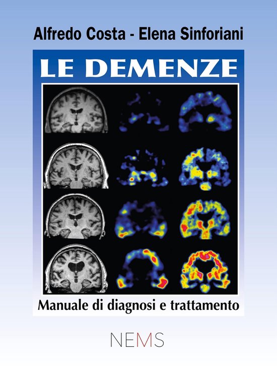 Le demenze - cover