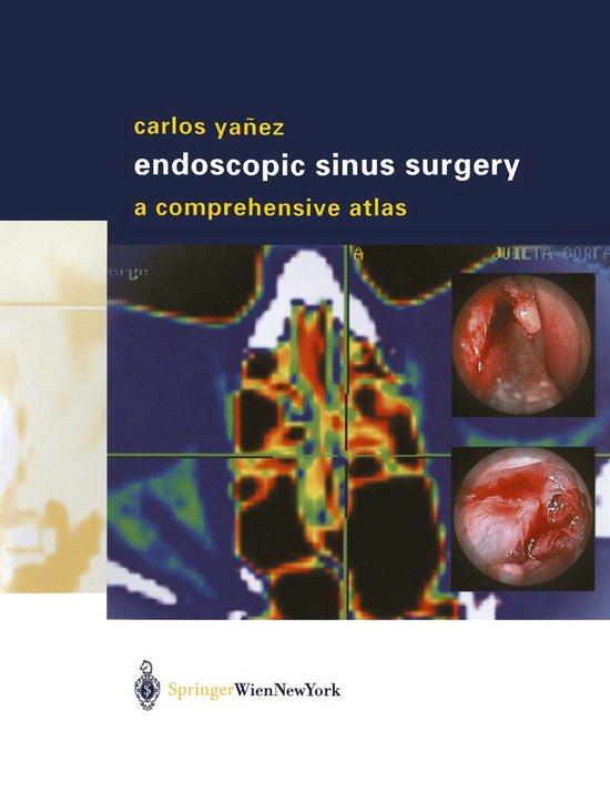 Endoscopic Sinus Surgery - cover