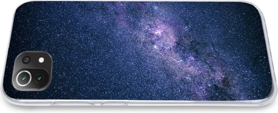 Coque Xiaomi 11T - Voie lactée - Etoiles - Espace - Garçons - Filles - Enfants - Coque en Siliconen