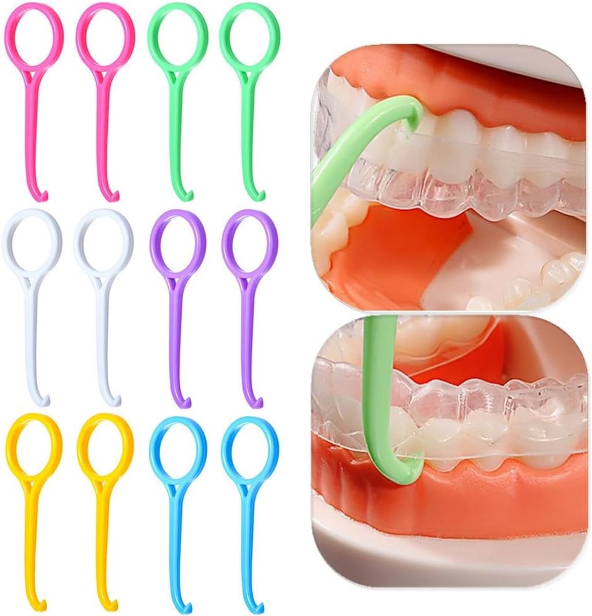 Professionele Verwijderingsset voor Beugels - 12 Stuks, Onzichtbare Orthodontische Hulpmiddelen in 5 Kleuren voor Eenvoudige Beugelverwijdering