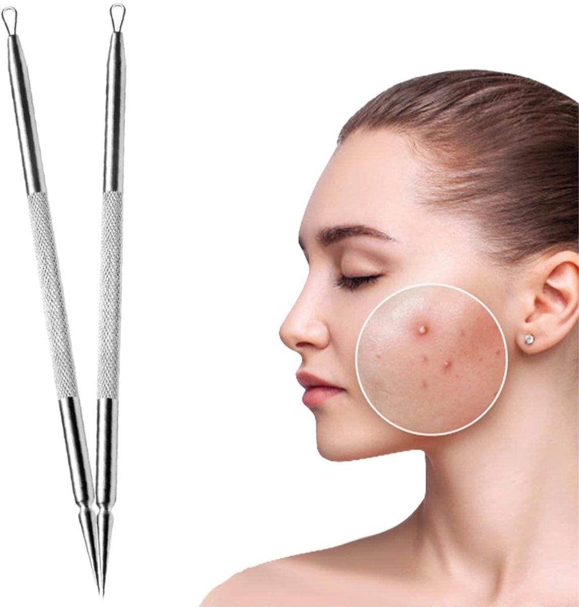 Dailygoods - 2 Stuks Mee-eters Verwijderaar - Acne Pincet en Comedonenknijper