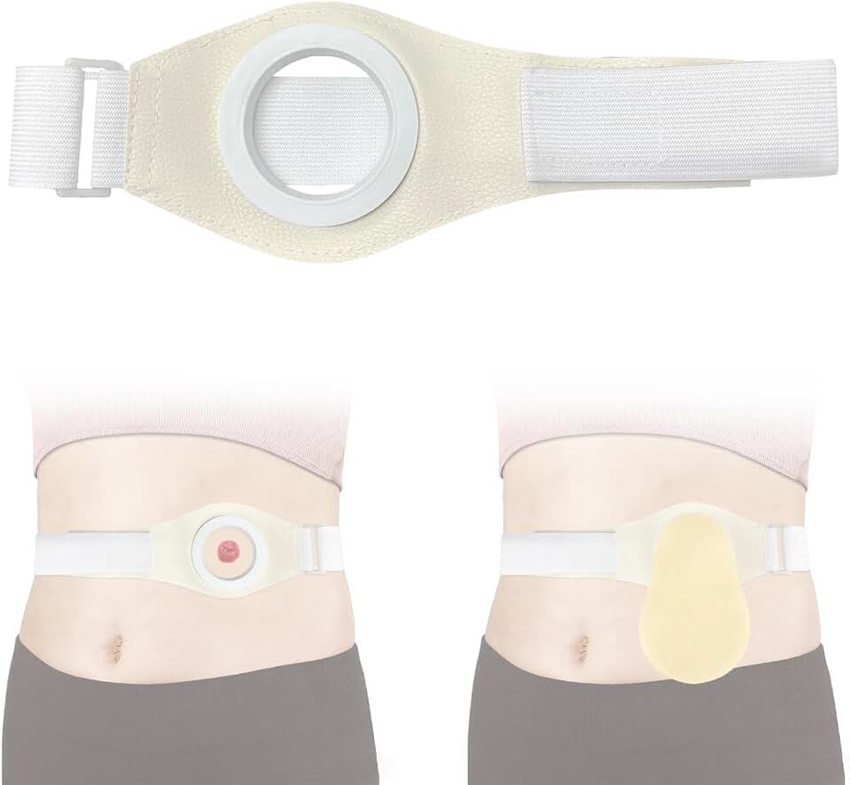 Support Belt Stoma Guard Band voor Abdominale & Colostomie Ileostomie Post-OperAtive Care, 39"L