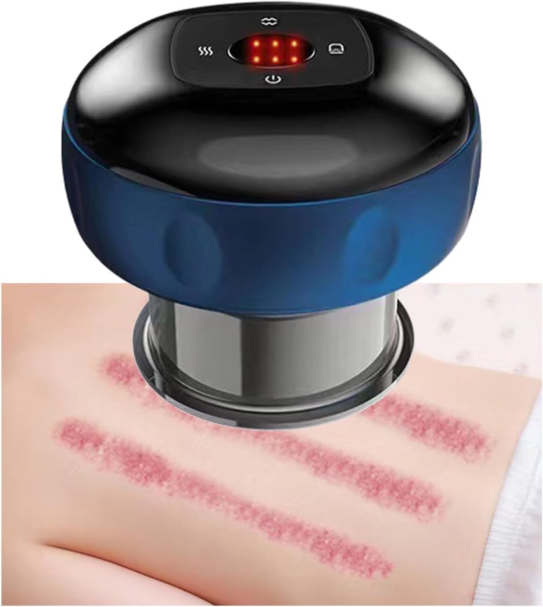 Draadloze cupping & gua sha massageapparaat - 6 standen - Verstelbare warmte - Draagbaar - Voor rug, schouders en benen - Blauw