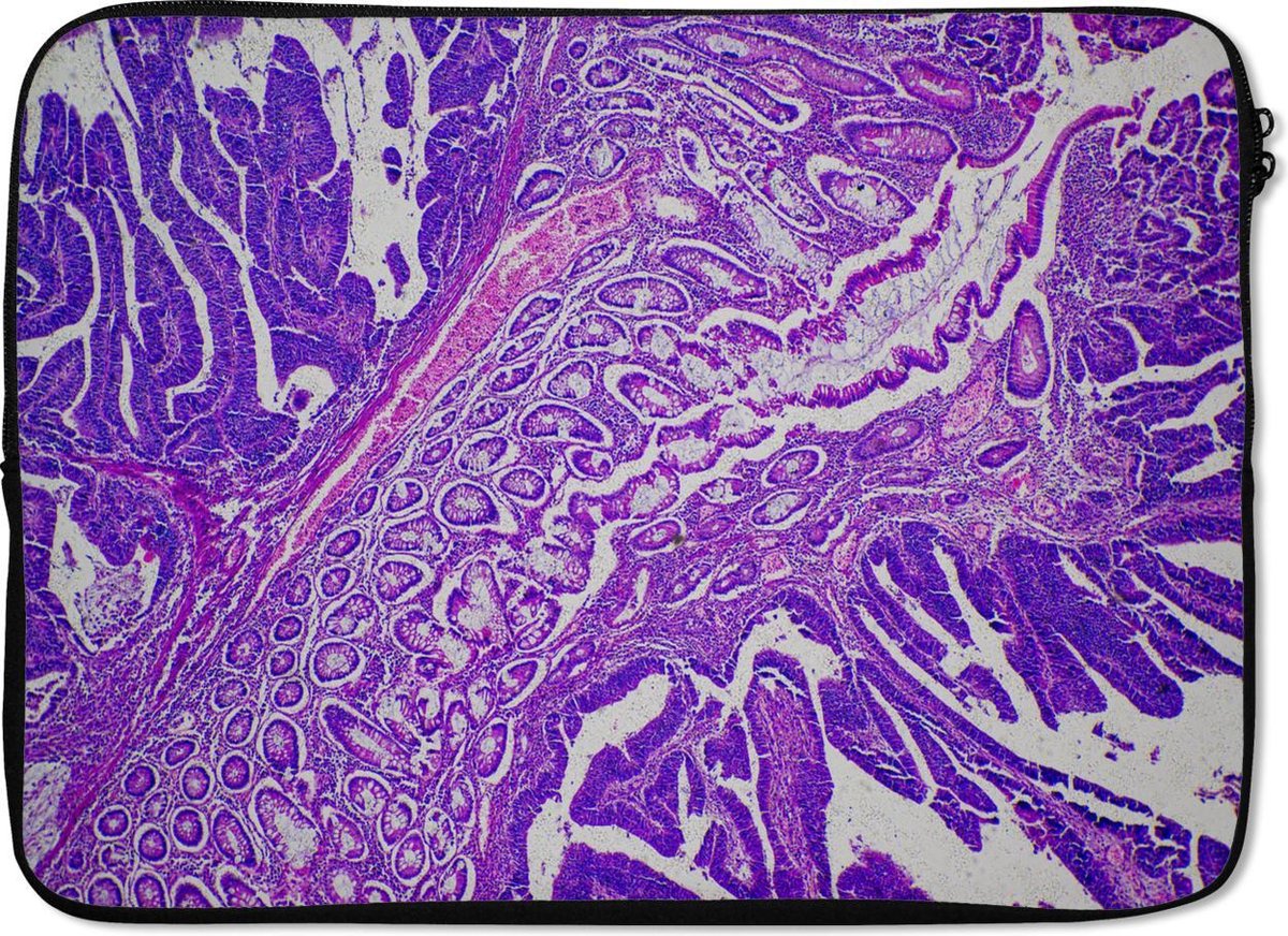 Laptophoes 13 inch - Bacteriën - Laptop sleeve - Binnenmaat 32x22,5 cm - Zwarte achterkant