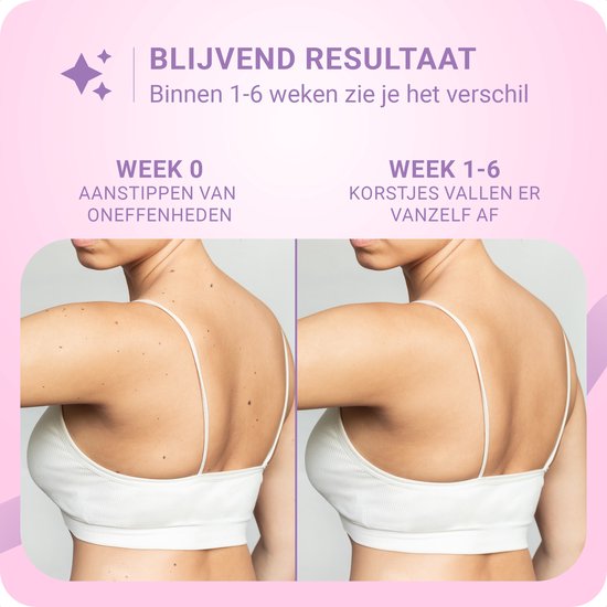Voor-en-na-foto's van de rug van een vrouw, die oneffenheden toont in week 0 en verbetering in week 1-6.