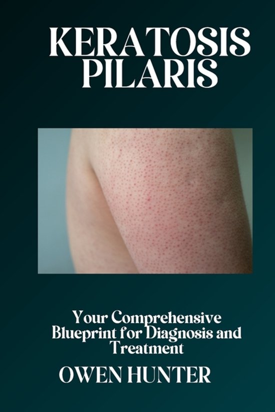 Keratosis Pilaris - cover