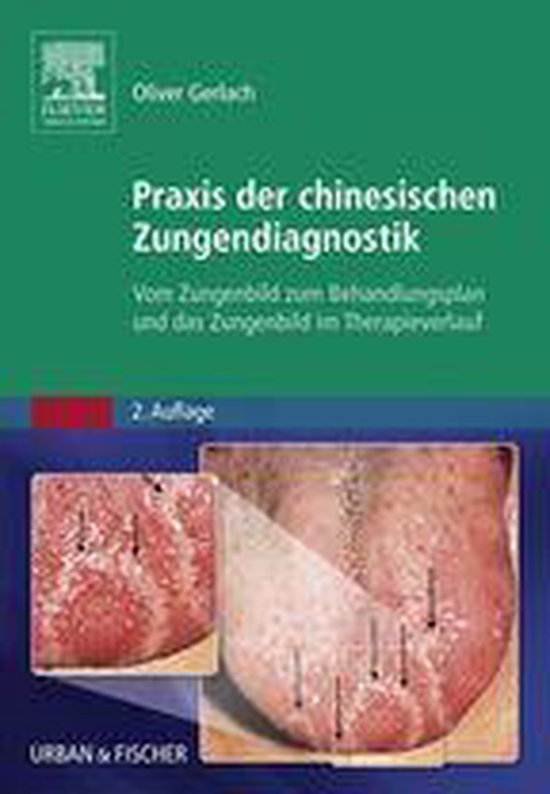 Praxis der chinesischen Zungendiagnostik (ebook), Oliver Gerlach ...