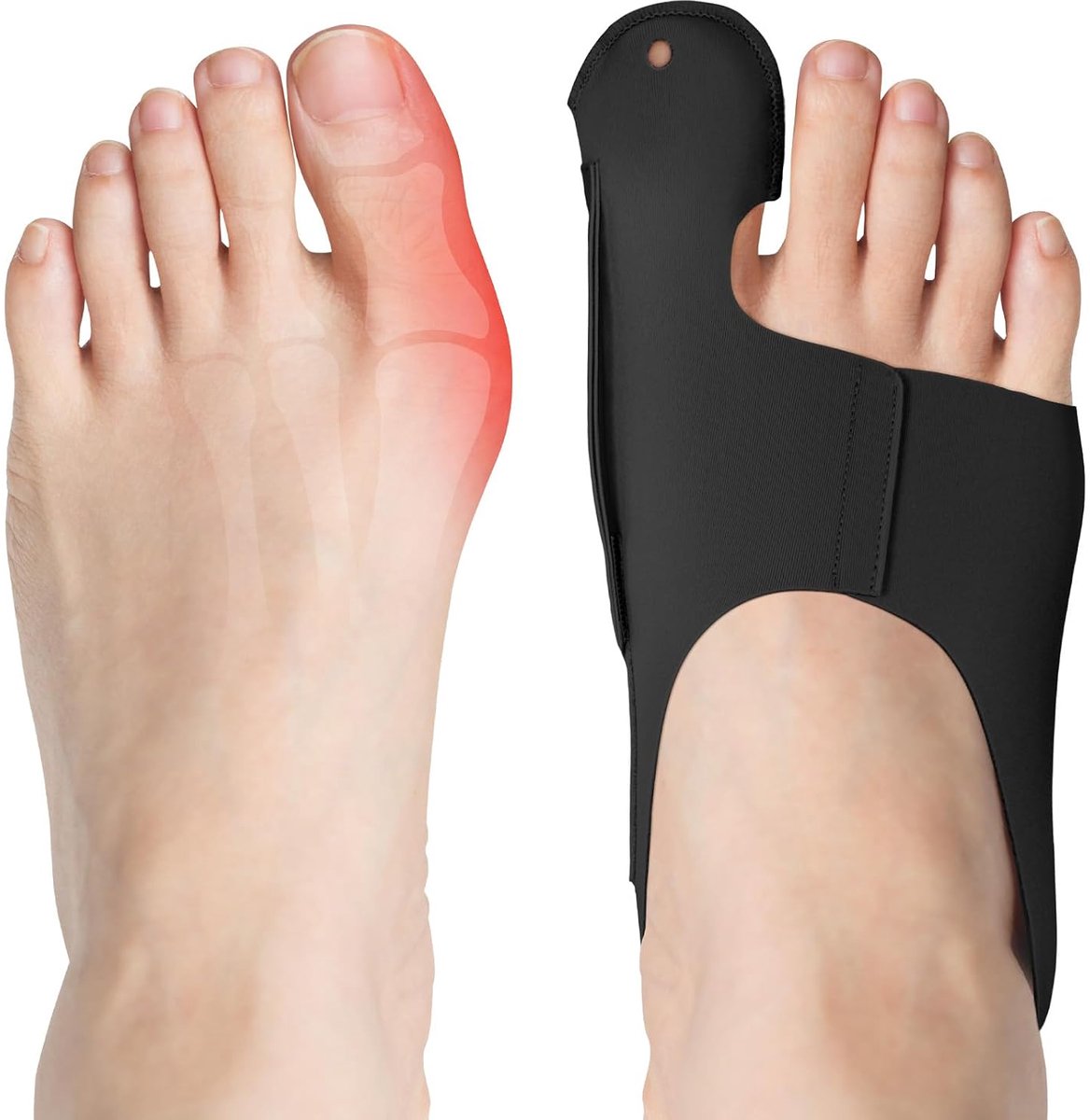 flintronic Hallux Valgus Correctie, 2-delige Teenspreider Hallux Valgus Correctieset, Bandage voor Mannen en Vrouwen, Grote Teen Bescherming (Zwart, M)