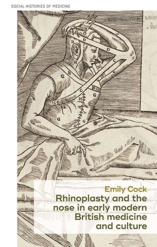 Social Histories of Medicine 25 - Rhinoplasty and the nose i ... - cover