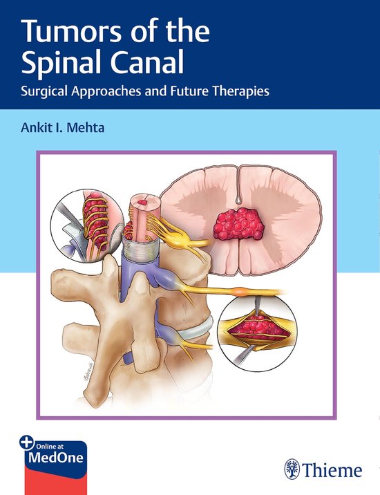 Tumors of the Spinal Canal - cover