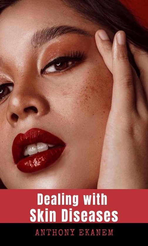 Dealing with Skin Diseases - cover