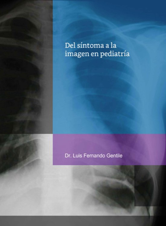 Del síntoma a la imagen en pediatría - cover