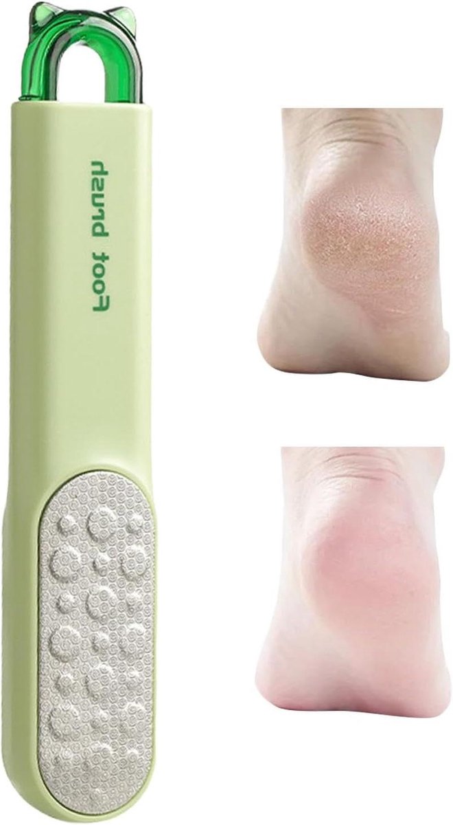 Voetscrubber Dode Huid - Voetvijl Callus - Zachte Voeten - Ergonomische Grip - 19 cm - Grijs