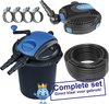 Aquaking Drukfilter Pf² 30 NG Vijverfilter Complete Set Incl. Vijverpomp, Waterslang & RVS Slangklemmen - Vijverpomp - Vijver - Vijverpomp voor in Vijver - UV Lamp Vijver - Vijverfilter