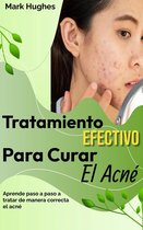 Tratamiento Efectivo Para Curar El Acné: Aprende paso a paso a tratar de manera correcta el acné