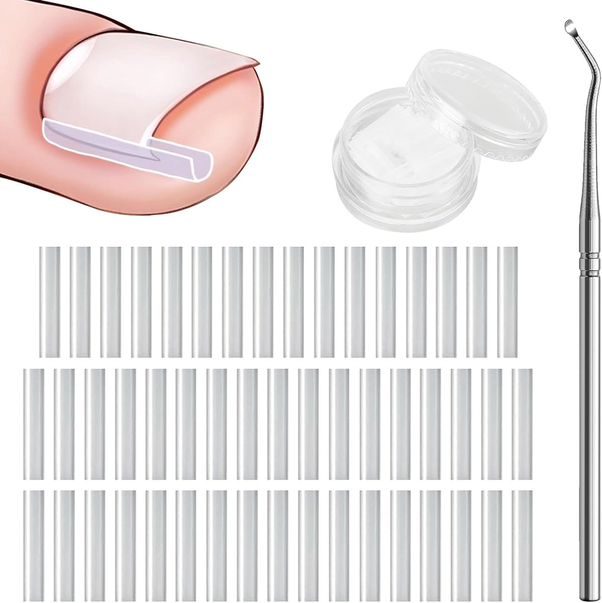 teennagel corrector set - 50 stuks pijnvrije teennagel rechttrekker strips met teennagel lifter - gemakkelijk te gebruiken ingegroeide teennagel gereedschapsset
