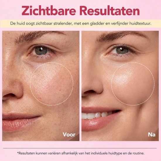 Voor en na foto van een gezicht dat de ATOANY crème gebruikt. De huid is stralender en gladder.