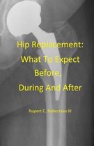 Hip Replacement