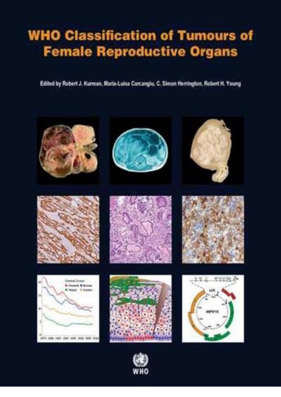 WHO classification of tumours of the lung, plura, thymus and ... - cover