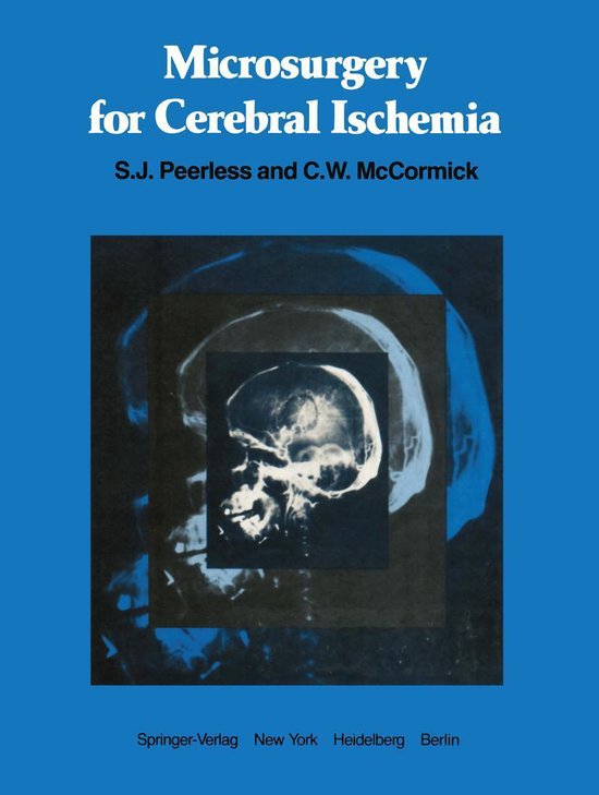 Medicine (R0) - Microsurgery for Cerebral Ischemia - cover