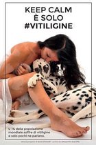 Keep Calm Solo #vitiligine