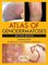 Atlas of Genodermatoses