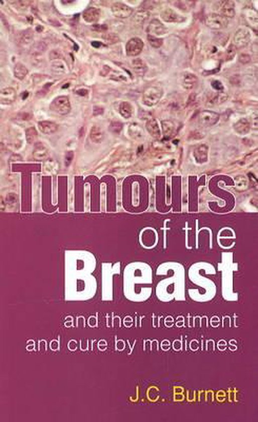 Foto: Tumours of the breast