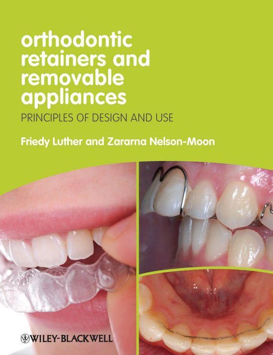 Orthodontic Retainers and Removable Appliances Bestel nu!