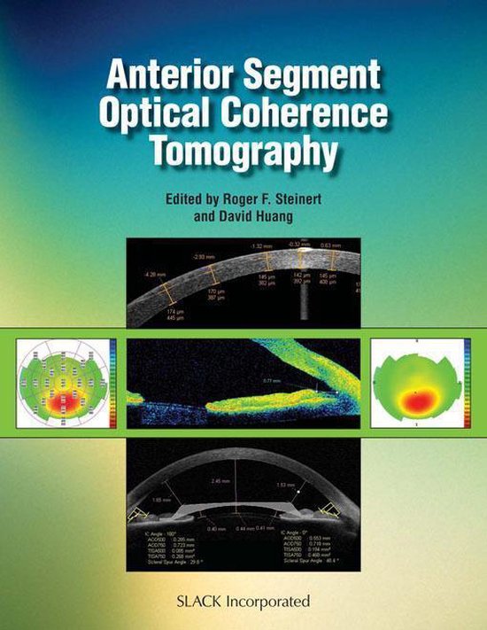 Anterior Segment Optical Coherence Tomography (ebook), Roger Steinert ...