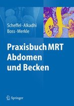 Praxisbuch MRT Abdomen und Becken