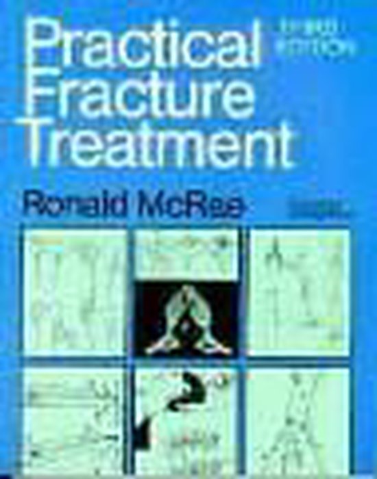 Practical Fracture Treatment - cover