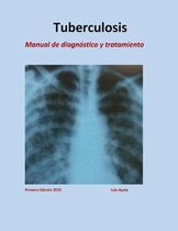 Tratamiento de Tuberculosis